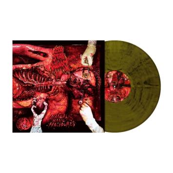 Manual Manic Procedures (seaweed vinyl)